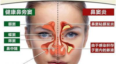 康丹堂:过敏性鼻炎鼻腔及其黏膜的结构 (中)