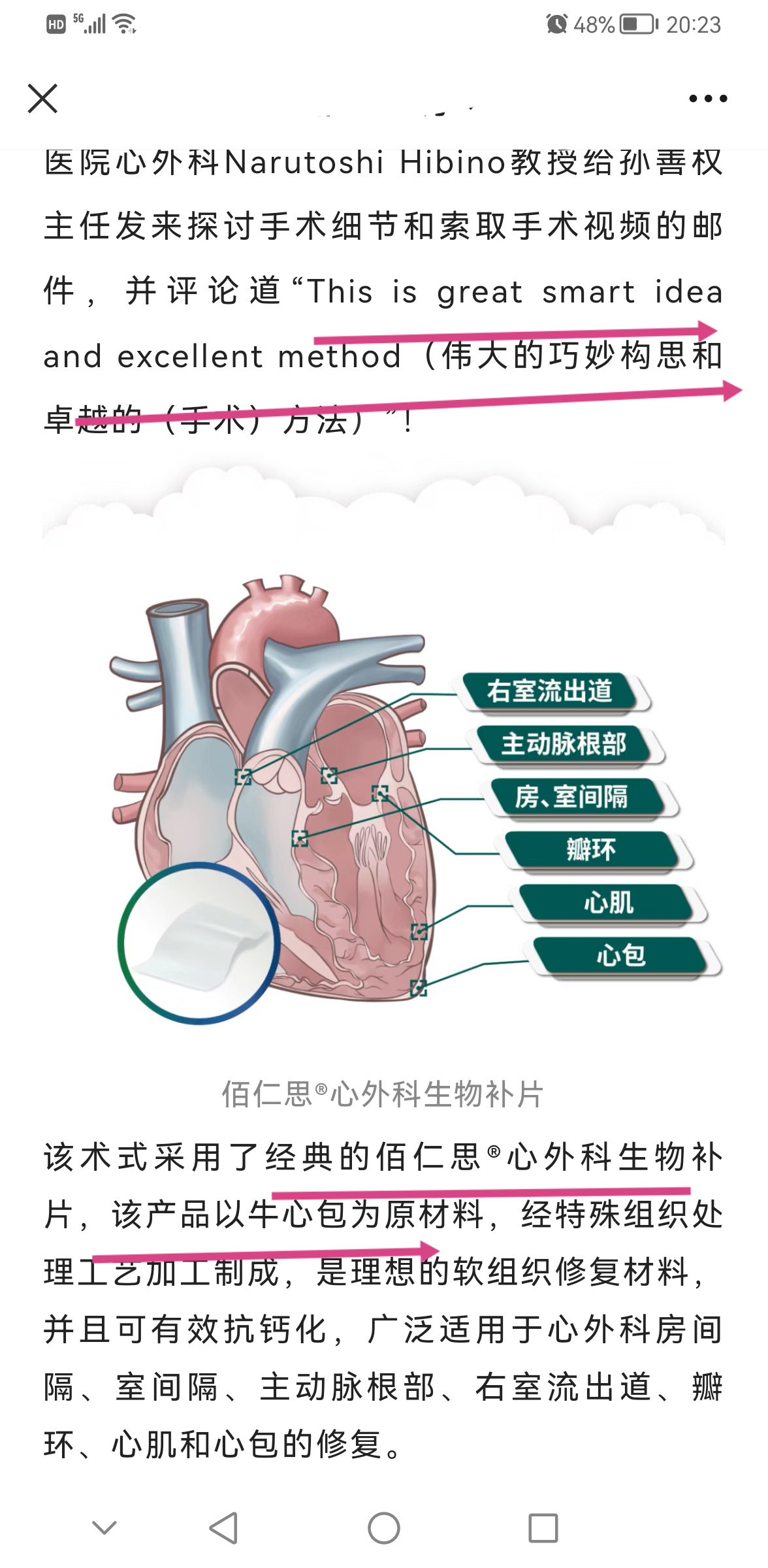 佰仁医疗sh688198中国首创v形补片技术治疗完全性房室间隔缺损自