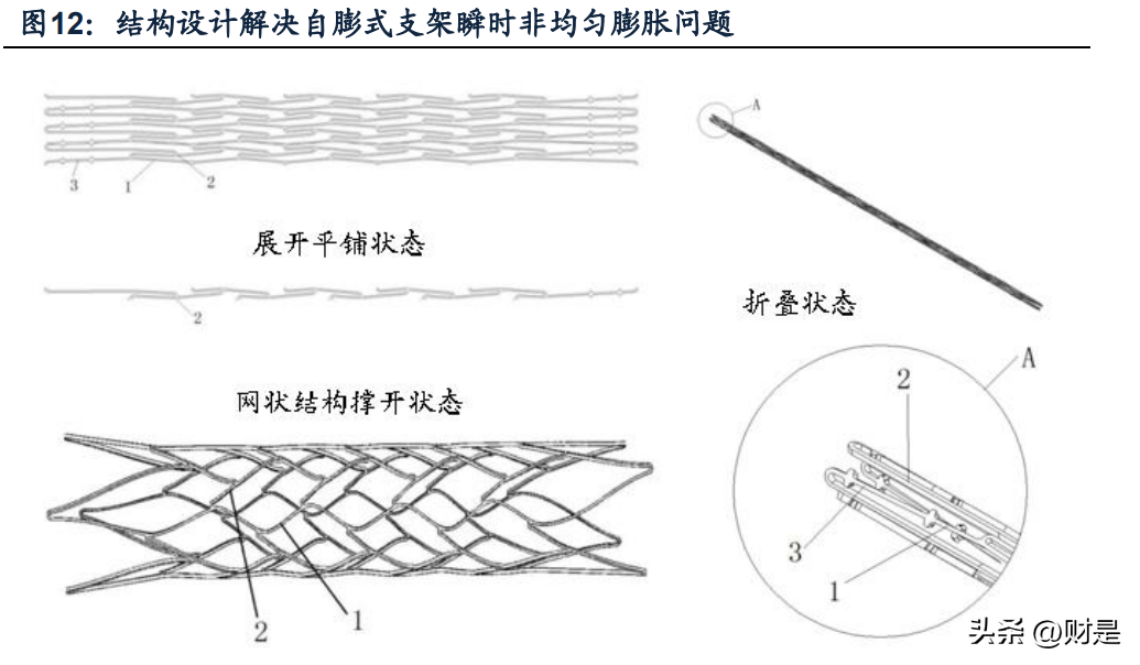 波科支架图片