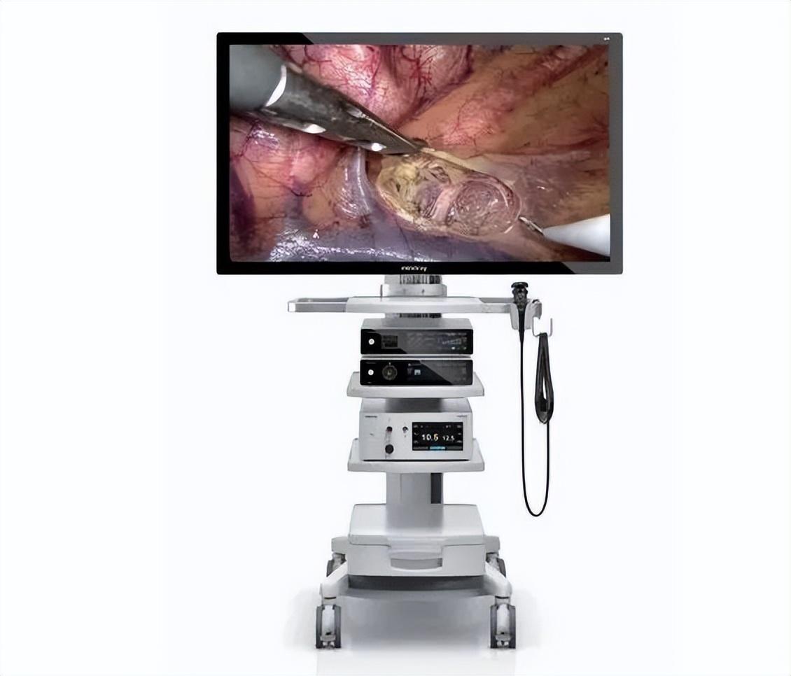 宾得医疗怎么样刚刚！全球内镜巨头：在上海成立生产研发中心_https://www.jmylbn.com_新闻资讯_第7张