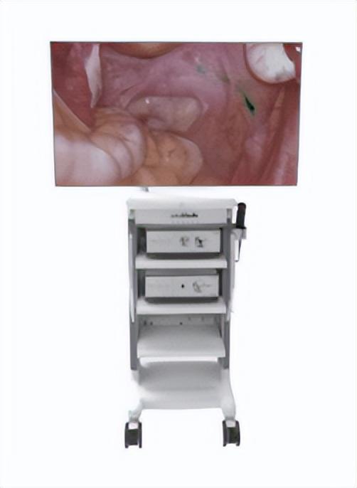 宾得医疗怎么样刚刚！全球内镜巨头：在上海成立生产研发中心_https://www.jmylbn.com_新闻资讯_第10张