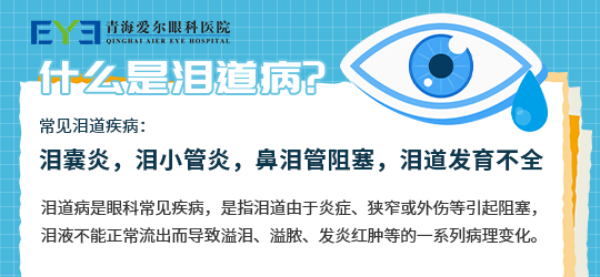 青海爱尔眼科:眼睛经常流眼泪?真相竟然是它 _财富号_东方财富网
