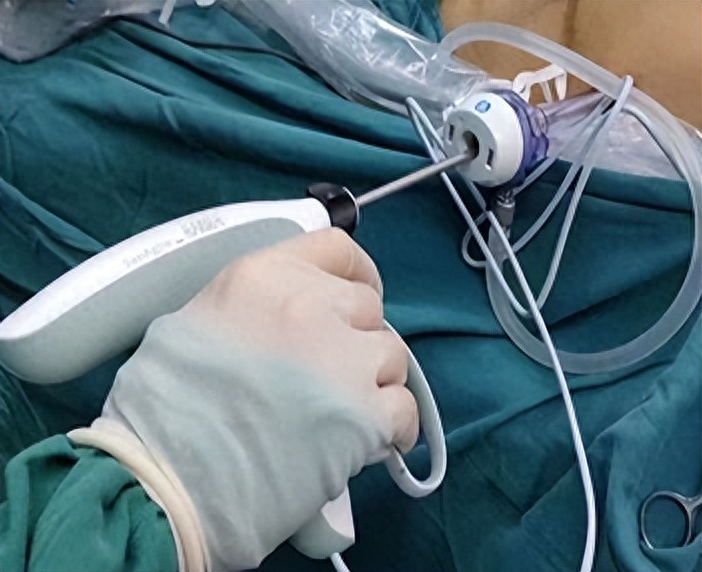 外科能量平台有哪些“中国能量”新发展，圣哲医疗积极响应国家战略_https://www.jmylbn.com_新闻资讯_第6张