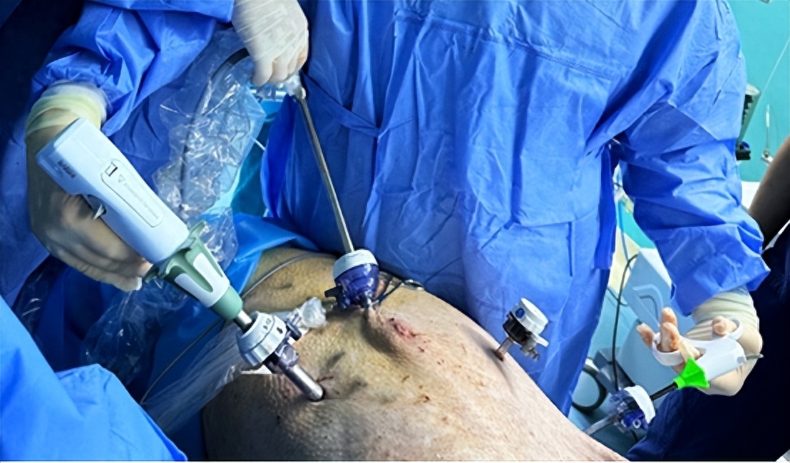 外科能量平台有哪些“中国能量”新发展，圣哲医疗积极响应国家战略_https://www.jmylbn.com_新闻资讯_第9张