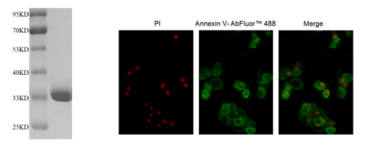 首页>创作中心>正文 左图:人膜联蛋白v/anxa5活性蛋白(d-akp303)的