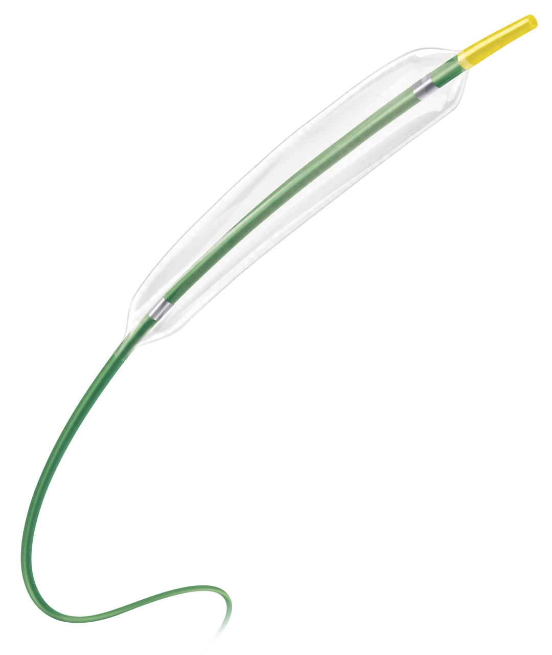 球囊是什么医疗器械“中国最大”，介入械企拟IPO_https://www.jmylbn.com_新闻资讯_第12张