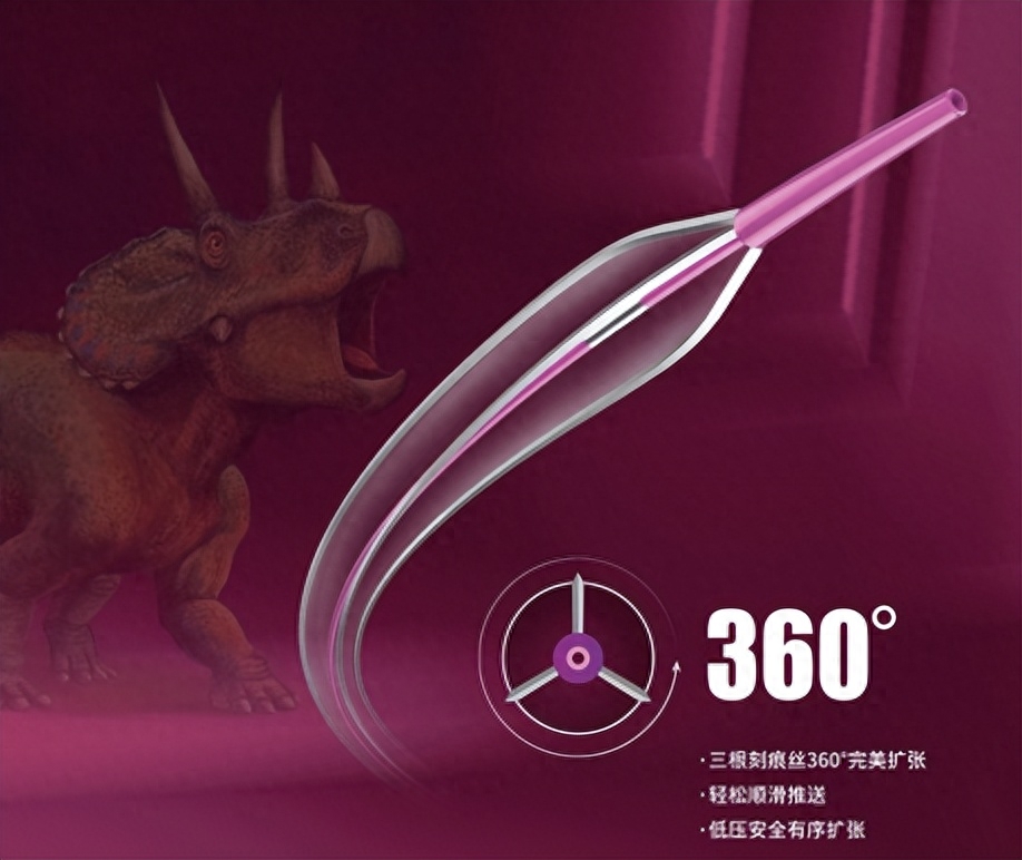 球囊是什么医疗器械“中国最大”，介入械企拟IPO_https://www.jmylbn.com_新闻资讯_第11张