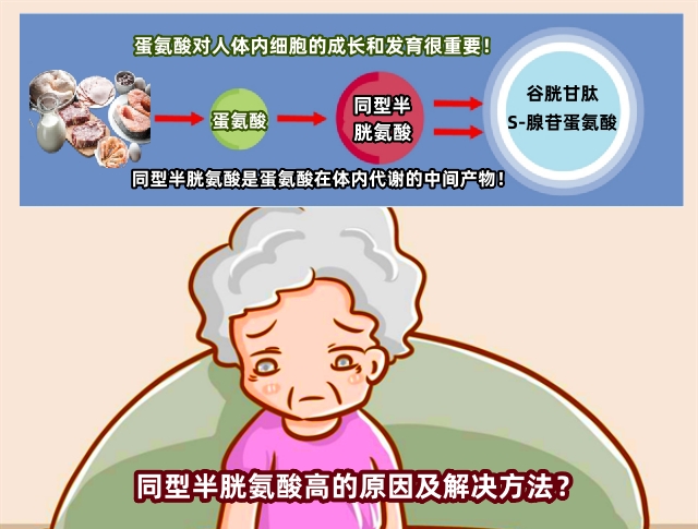维兰尼健康科普同型半胱氨酸高的原因及解决方法