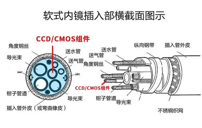 技术大爆发浅析4k技术在医用内窥镜领域的应用