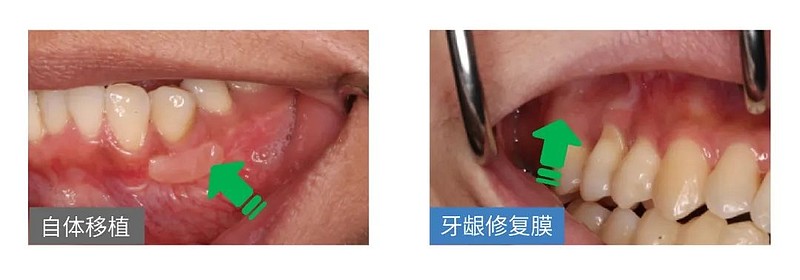 國產首證千億風口賽道重磅創新產品獲批