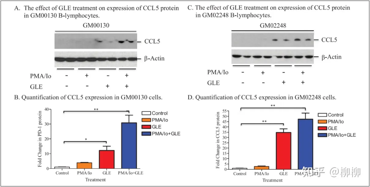 此外,研究還發現,gle處理人b淋巴細胞gm00130和gm02248顯著上調趨化