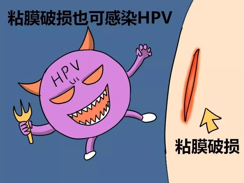 貴陽長江醫院醫師解答hpv感染後疣體生長的時間差異