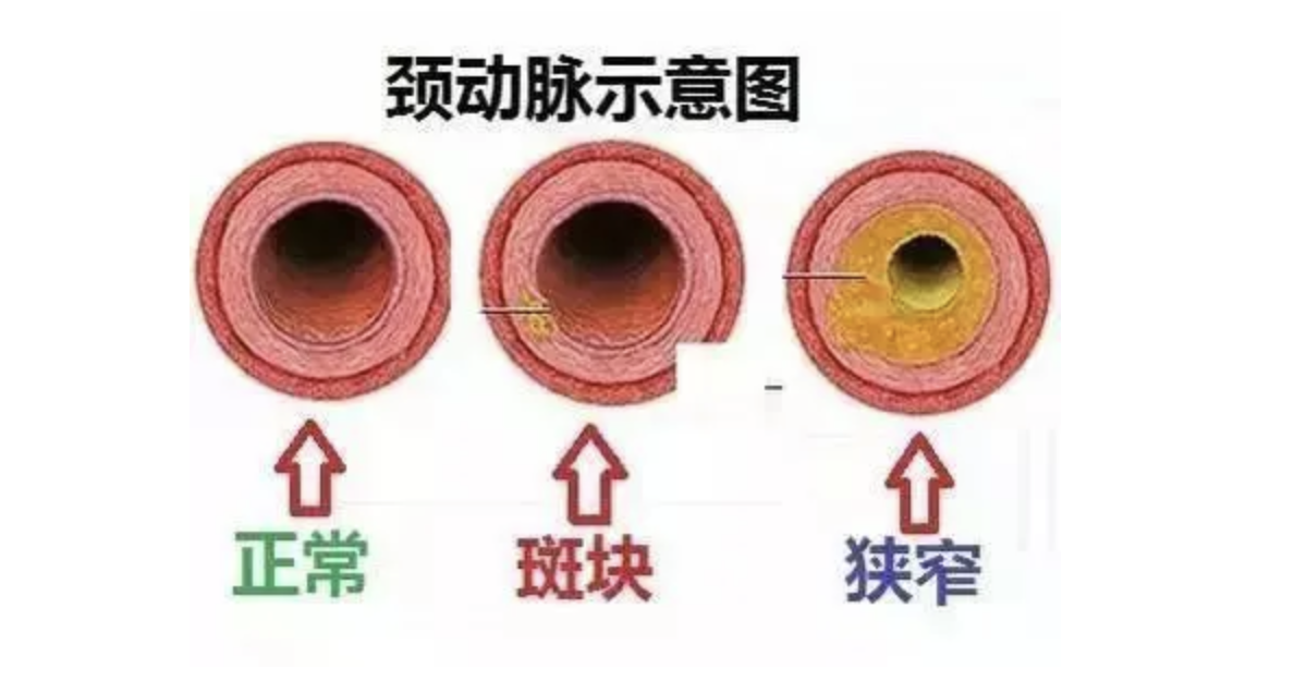 中医张问渠教授指出