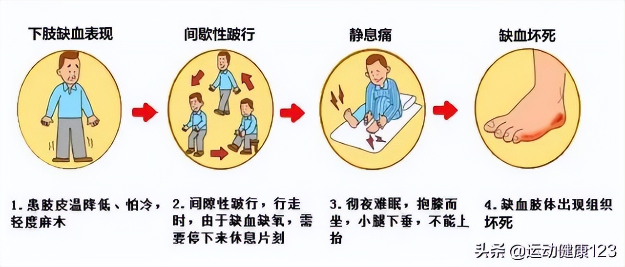 犀说北交所诺思兰德深耕缺血性疾病基因治疗核心产品上市在即重点瞄准
