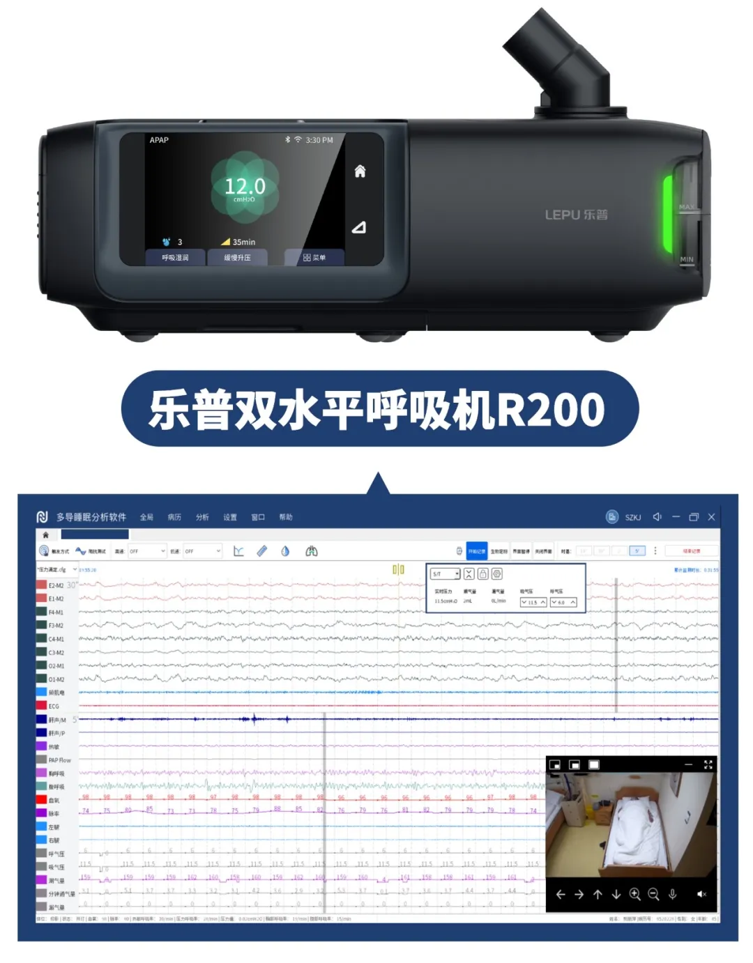 乐普呼吸机助力云南省第一人民医院,打造源头诊治 智能监测特色睡眠障