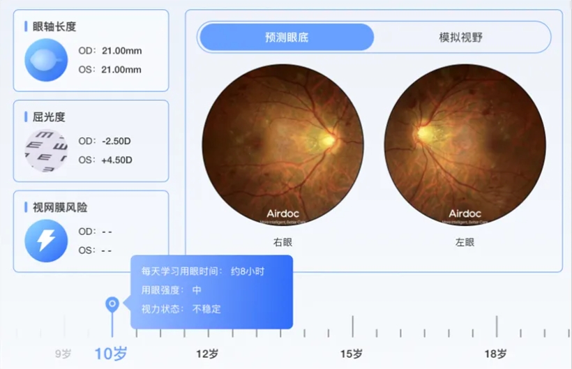 眼底照相正常图片解读图片