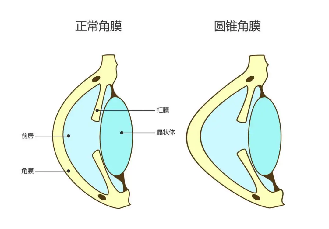 眼角膜的位置图片