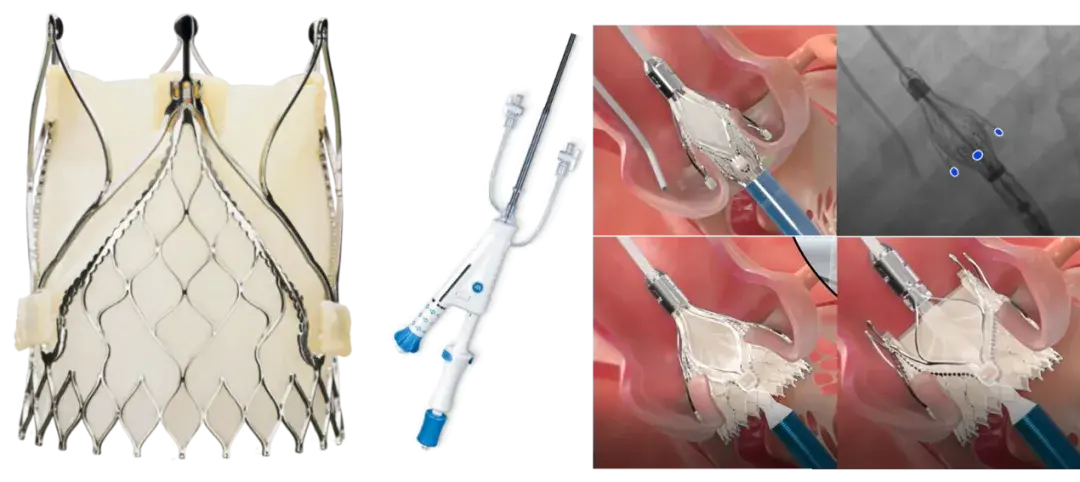 医疗公司有哪些产品器械之家：2024十大心血管创新产品_https://www.jmylbn.com_新闻资讯_第5张