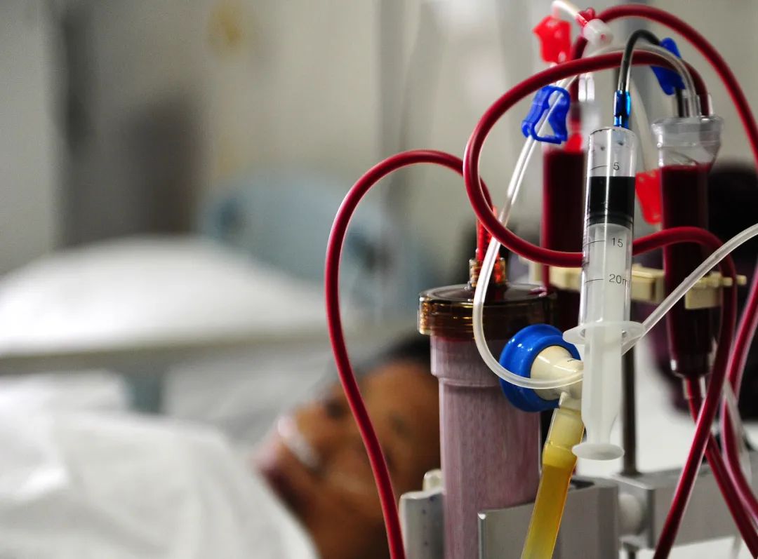 国元证券研报数据显示,其中高通量透析器报价区间在54.5元～77.