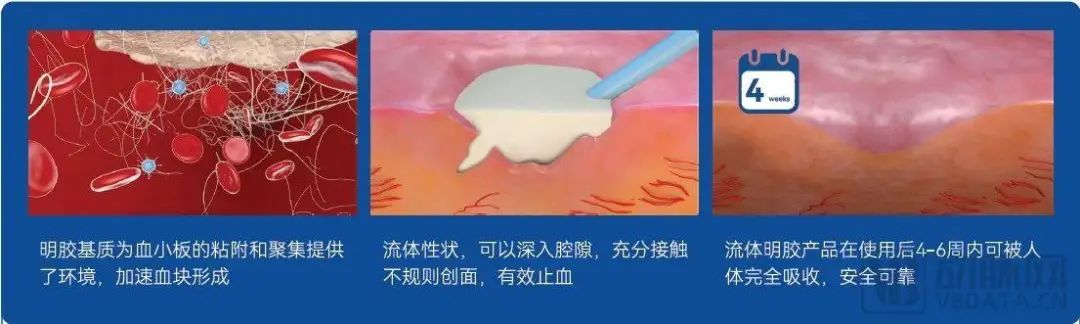 止血微球怎么用今晚直播｜博恩锐尔：国产首款自主研发可吸收止血流体明胶【动脉严选新品鉴第74期】_https://www.jmylbn.com_新闻资讯_第2张