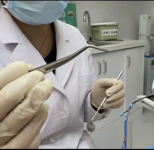 卡了2天的鱼刺,在南京仁品医院终于取出来了