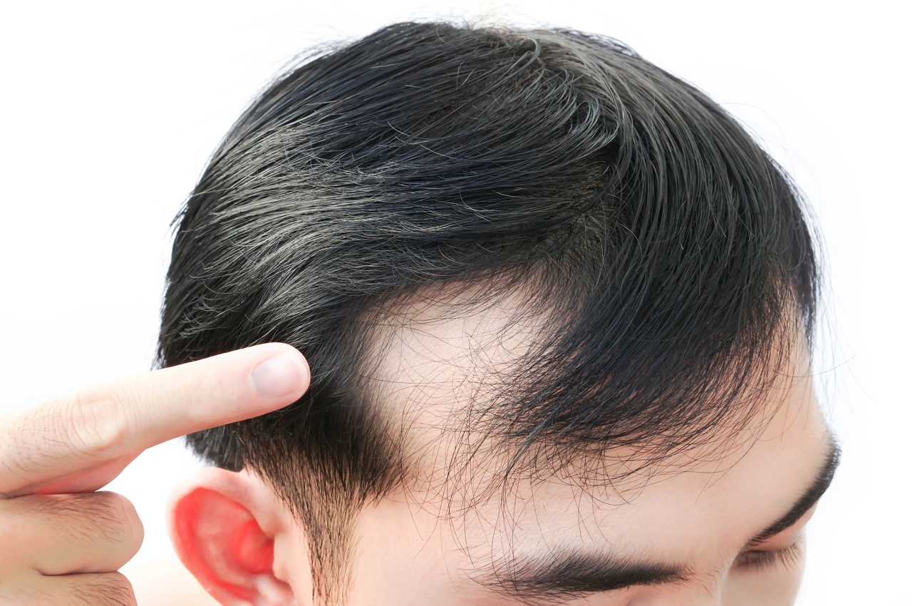 雍禾醫(yī)療，種得青絲難解愁
