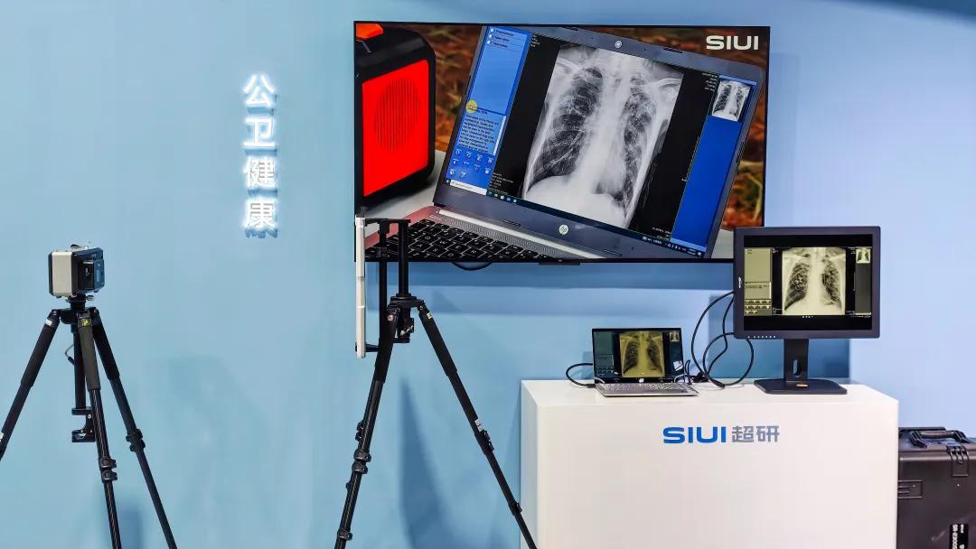 什么是超声容积探头CMEF启幕：超研股份以专科化之力，重构医学影像新生态_https://www.jmylbn.com_新闻资讯_第6张