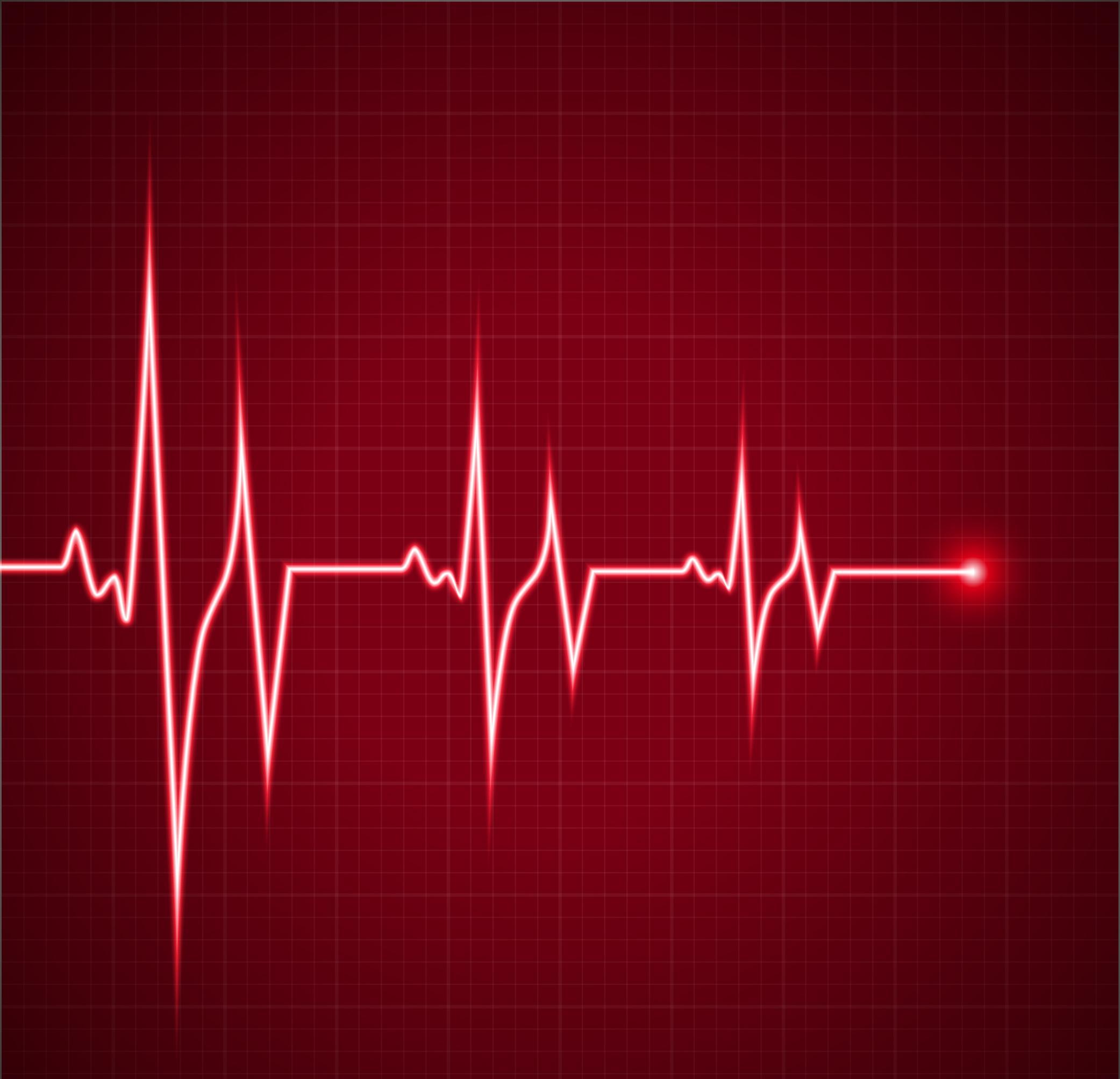 这个股走势就是心电图一样好像是市值上千亿的银行股走势什么情况啊