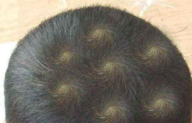 今日macd绿柱继续变短,即将金叉,到了临界点,是死是活,今天要水落石出