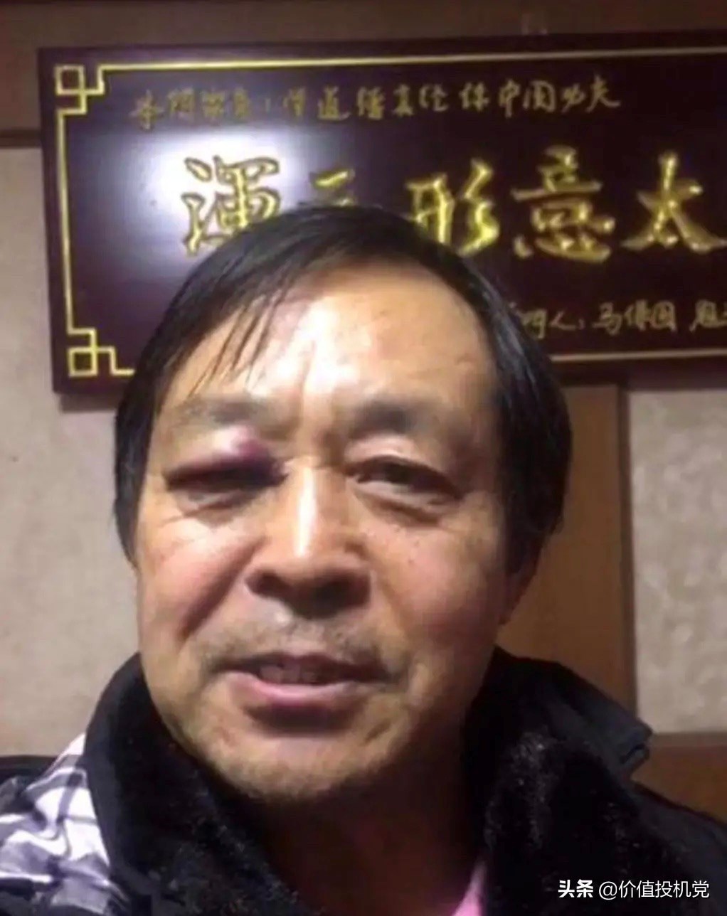 总有一天这家公司的姓赵的这家伙会被打的跟这个差不多.