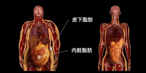 内脏脂肪和皮下脂肪图图片