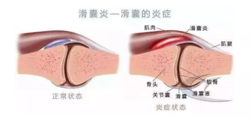 改善滑囊炎如何做看秀域展示中国科技的力量