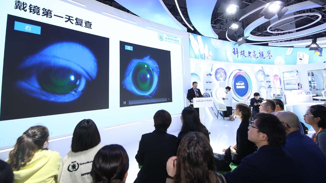 爱博医疗携全线产品亮相展会不仅有普诺瞳ok镜rgp离焦镜硬镜护理系统