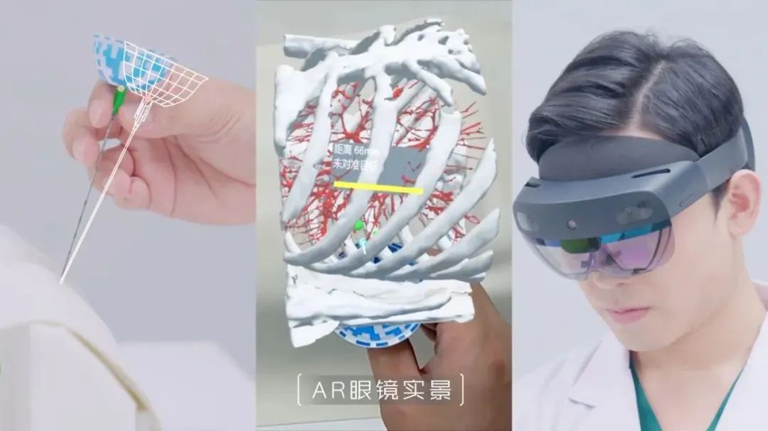 全球首创!复拓知达自研AI-AR导航设备获批,引领肺结节术中定位新时代_财富号_东方财富网